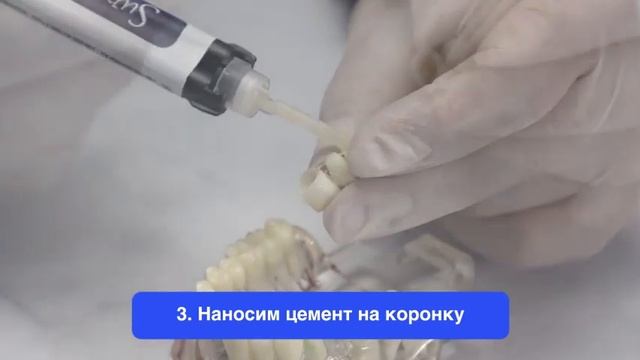 Новинка! Цемент для постоянной фиксации Supercem.