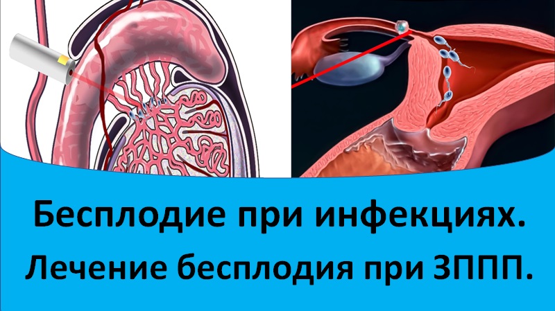 Бесплодие при инфекциях