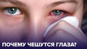 Чешутся ГЛАЗА: возможные ПРИЧИНЫ ЗУДА