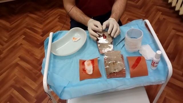 Ожоги и отморожения