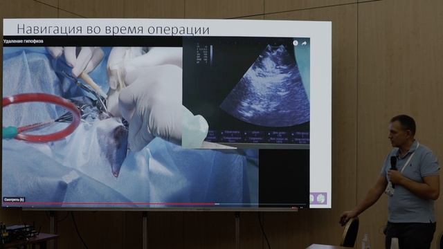 Удаление новообразований гипофиза