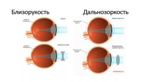 Гигиена зрения