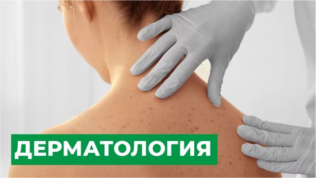 Дерматология. Когда стоит обратится к врачу-дерматологу