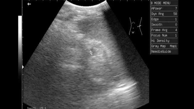 20110422-080556.mpg смотреть онлайн