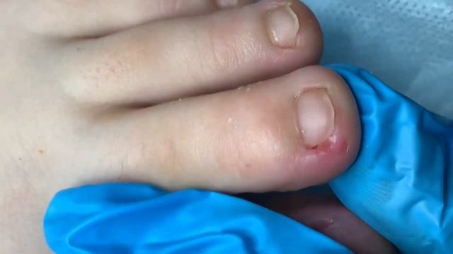 Острый шип?⚠️?❗️ смотреть онлайн