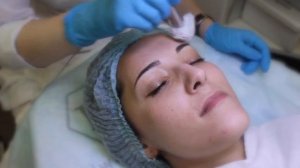 Гальваническая чистка лица. Центр эпиляции и косметологии Казань