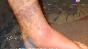 Про укусы ядовитых змей.