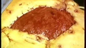 Лечение ран в управляемой абактериальной среде, 1982г.