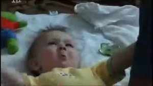 Пароксизмальное тоническое закатывание глаз (Paroxysmal Tonic Upgaze - PUT)