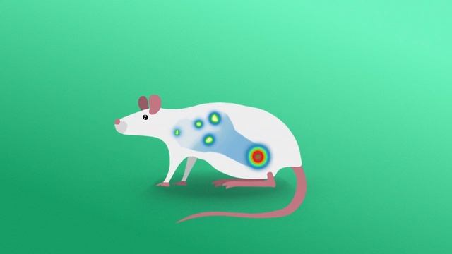 Early detection of melanoma metastasis and new targets for treatment