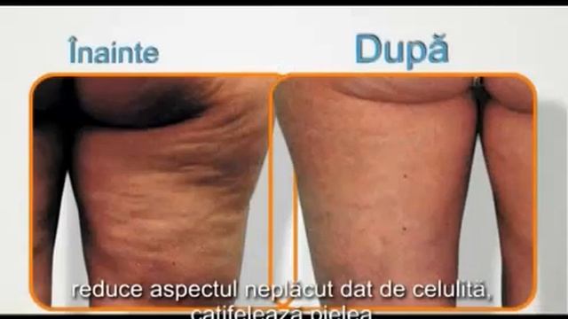 Массажер антицеллюлитный Celluless Md