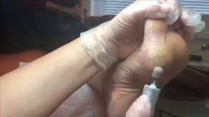 Аппаратный педикюр.