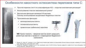 Перипротезные переломы бедра после эндопротезирования тазобедренного и коленного сустава.