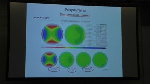 Современные возможности эксимерлазерной коррекции.  Солодкова Е.Г. (Волгоград)