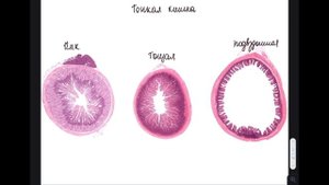 Гистология кишечника | Разбор гистологического препарата