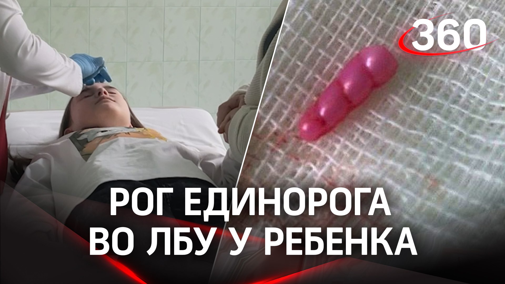История про большую любовь к единорогам и невнимательных врачей