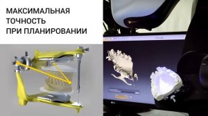 inEos X5 Сканирование гипсовых моделей в программе inLab SW