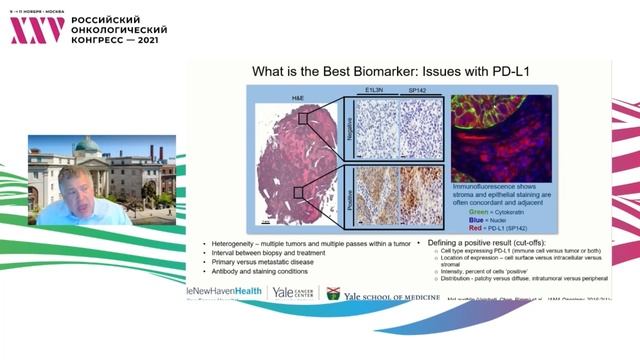 Оптимальная тактика палиативной терапии НМРЛ. Место ингибиторов контрольных точек смотреть онлайн