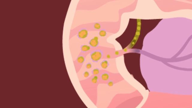 16. Желудок и кишечник . Окружающий мир - 3 класс смотреть онлайн
