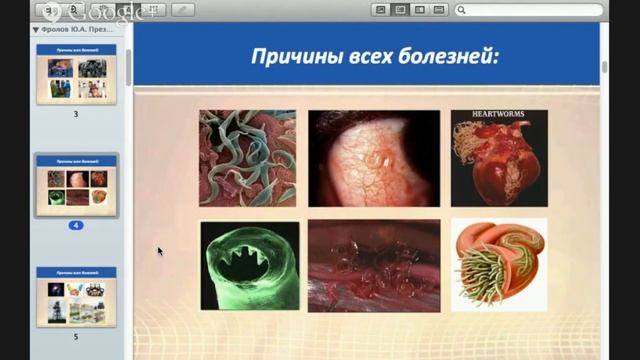 Как устранить причины всех болезней? Мастер-класс. Секреты Мастеров смотреть онлайн