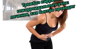 Тромбоз наружного геморроидального узла: лечение, как быстро проходит