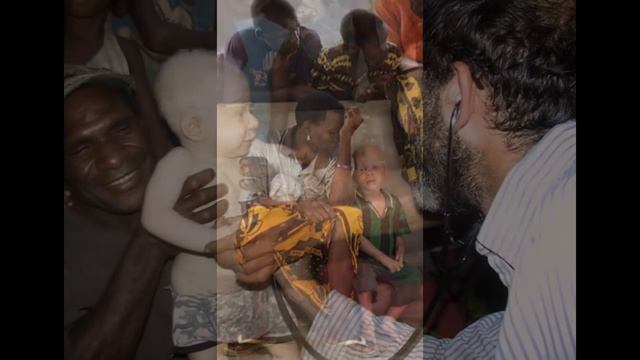 albinos among the peoples of Africa - альбиносы среди народов Африки смотреть онлайн