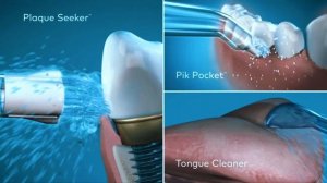 Top 5: Best Water Flosser in 2024 [Unlock Secrets Before You Buy!]