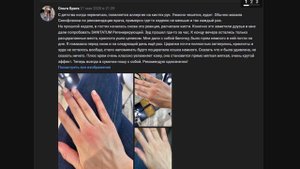 ЗУД КОЖИ? РАЗДРОЖЕНИЕ? КРЕМ "САНИТАТЕМ" ПОМОЖЕТ ВСЕМ!