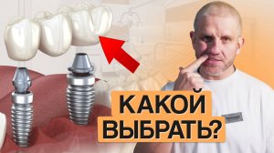 ЗУБНЫЕ МОСТЫ: виды, цены, гарантии и КАК ВЫБРАТЬ ЛУЧШИЙ?