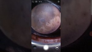 Эндоскопия Рено Логан перед покупкой. 89268125557 Антон выездная диагностика по Москве.и МО.