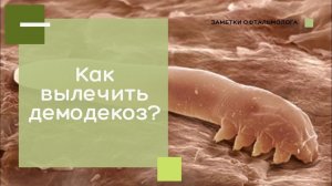 Демодекоз / Гигиена век при демодекозе