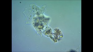 Амеба под микроскопом ameba under microscope