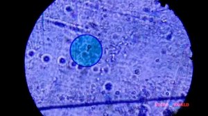 Танцующие бактерии и инфузории под микроскопом "АНАЛИТ" MICRO WORLD #5