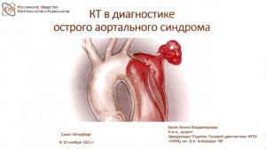 КТ в диагностике острого аортального синдрома