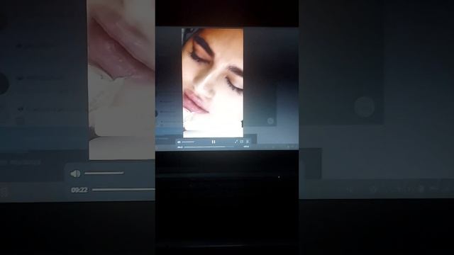 Видео курсы по увеличение губ игольно все виды и техники. отрывок от видео курса.