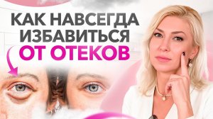 Отеки и мешки под глазами — ТОП 5 помощников от отеков. Разберись с отеками раз и навсегда!