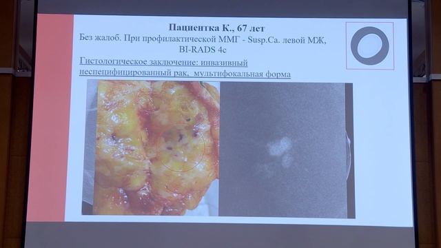 Черная А.В. — Возможности контрастной маммографии смотреть онлайн