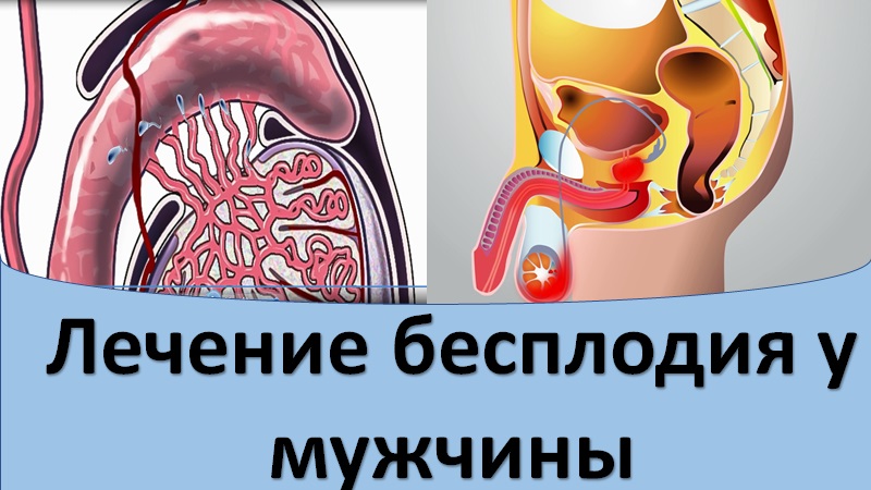Лечение бесплодия у мужчины с трихомониазом и хламидиозом