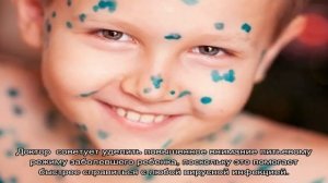 Как начинается ветрянка: первые признаки