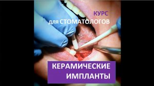 Керамические импланты. Семинар для стоматологов. Квадратный формат ВИДЕО для медицины.