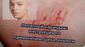 Ляписный карандаш: инструкция по применению, цена, аналоги
