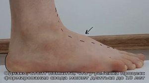 Что такое подъем стопы