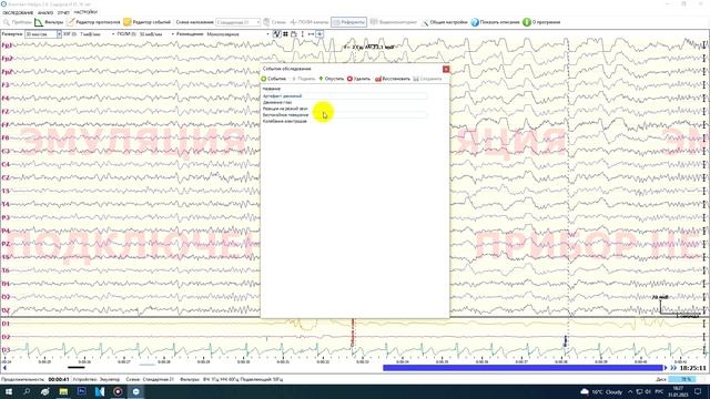 4  Интерфейс и основная функциональность программы Компакт-нейро