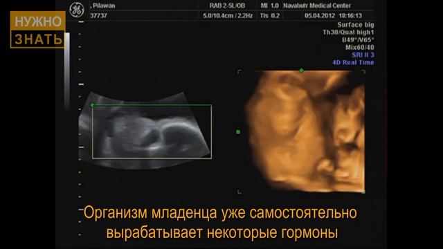 28 неделя беременности. Развитие плода. УЗИ 3D и 4D. Что чувствует беременная. Как выглядит ребенок