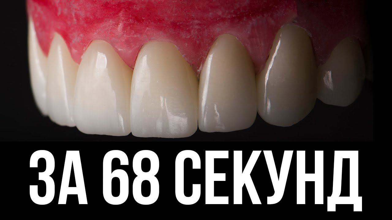 Как создаются виниры за 68 секунд. dental cad cam