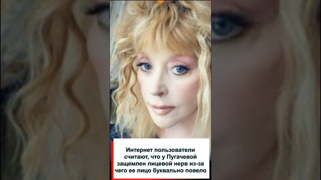 У Пугачевой "уехал" нос, начали "плясать" глаза, после многочисленных омоложений поплыло лицо