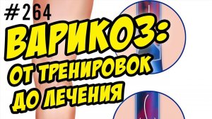 варикоз. варикоз и фитнес. причины и лечение варикоза. всё про варикоз