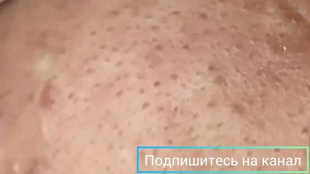 Чёрные точки ? Black dots