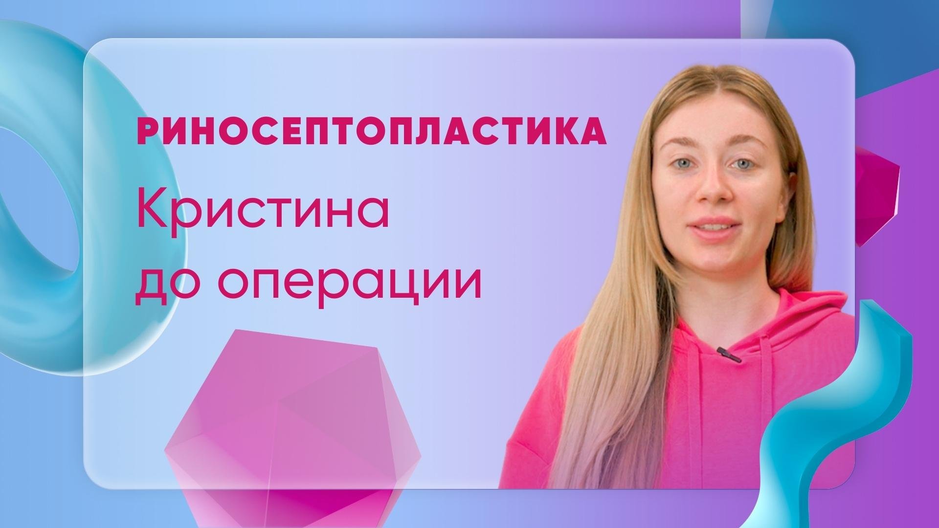 Риносептопластика. Кристина. До операции