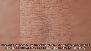 Как лечить грибок у собаки?
